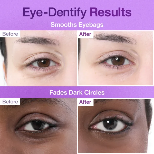 No.9 Nad + Collagen Under Eye Patches - Numbuzin