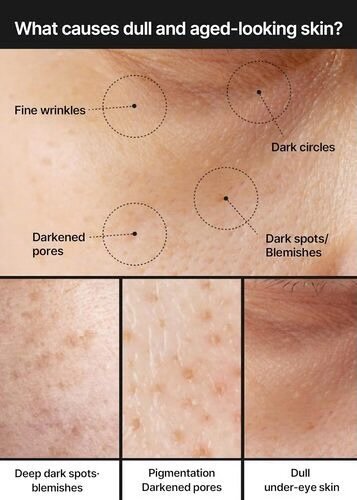 Pore + Dark Spot Brightening Cream 35ml - Celimax